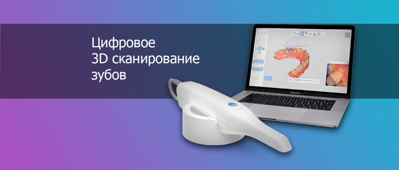 Цифровое 3D сканирование